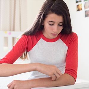 Good Skin Knowledge: Lesson plans: Module 10: Psoriasis
